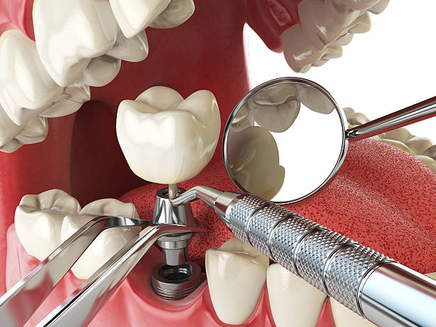 Best Emergency Cosmetic Dentistry (e.g., broken veneers) in Winnsboro, SC